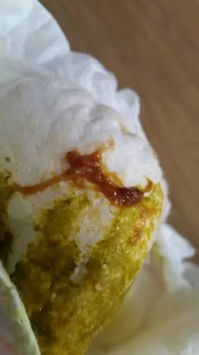 我女儿,四天前中午突然便血,中午去医院看说是肠炎.