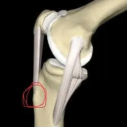 膝盖下面5厘米处有一个突出的骨头,按着不疼走路摸着也不疼