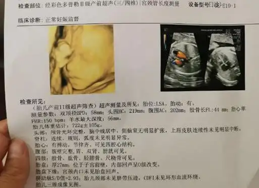 四维彩超清晰图片怎么看男女方法1,方法一:在四维彩超单子上面的右上