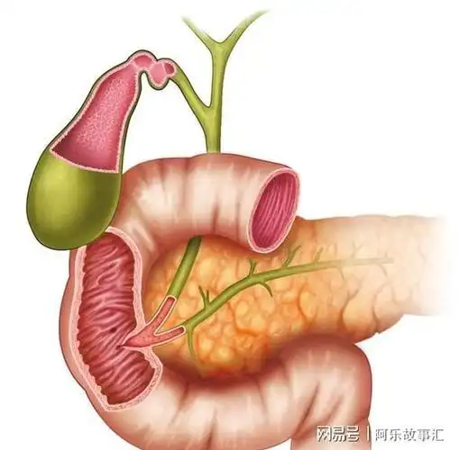 虚惊一场胃上的肿瘤不是胃癌而是一块调皮的胰腺组织