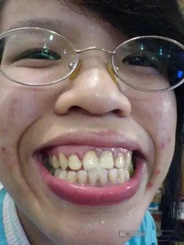 网络评选出的十大恶心丑女!