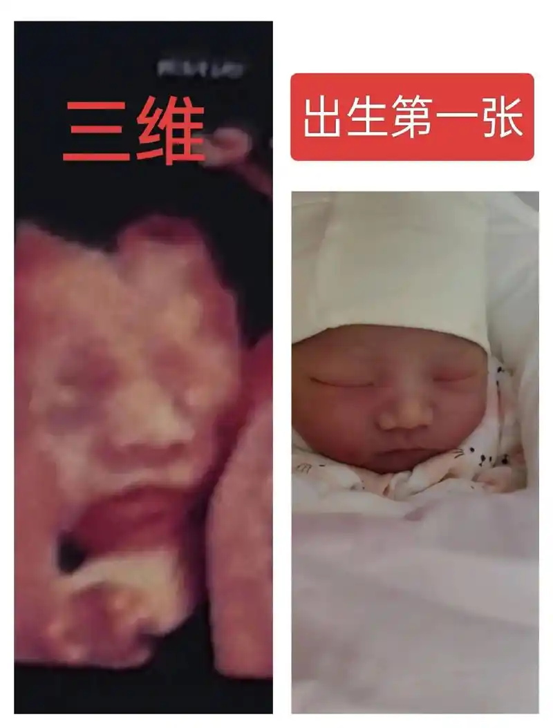 2024.3.30 今天是小宝出生的第28天了 怀孕 - 抖音