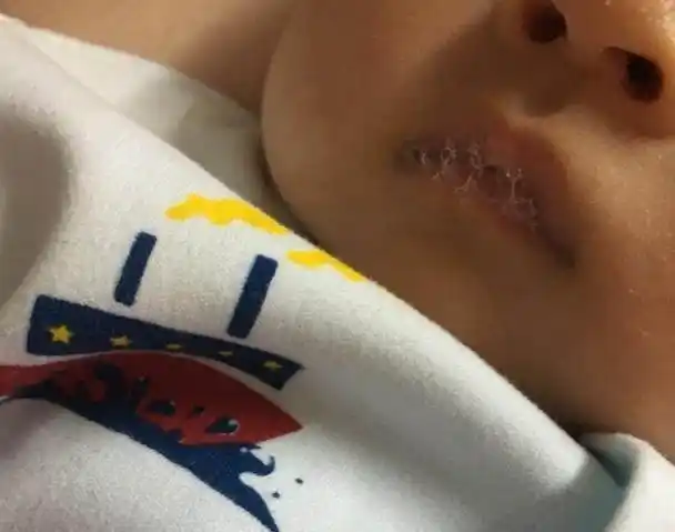 宝宝吐泡泡一定是肺炎这两种情况下需要谨慎对待