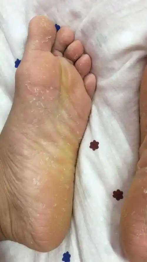 我的脚容易出汗,一天走下来鞋子总归有异味,后来穿了五指袜稍微好点