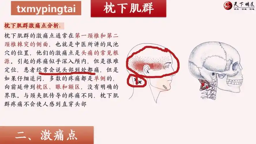 枕下肌群的位置,枕下肌群的功能,枕下肌群的激痛点,枕下肌群损伤后的