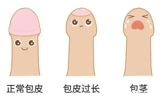 男生割包茎会变大吗,青春期之前割会长大/成人割不会