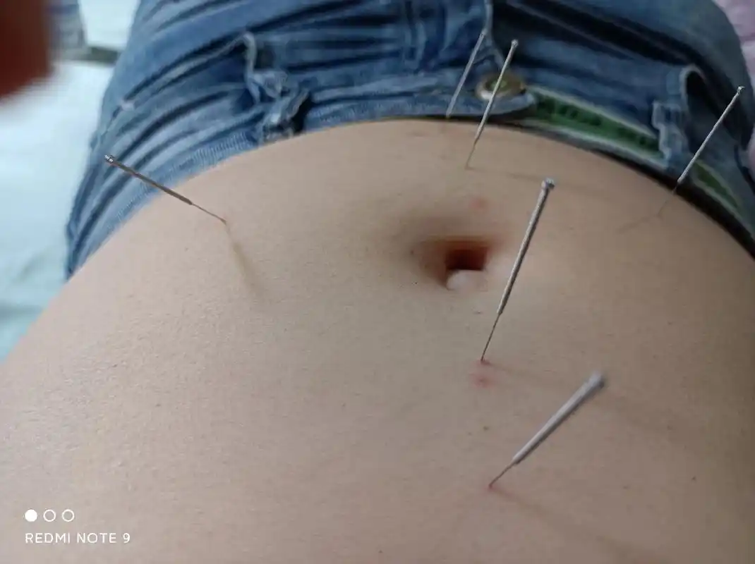 经络疏通 #体内有淤堵.黑血 - 抖音