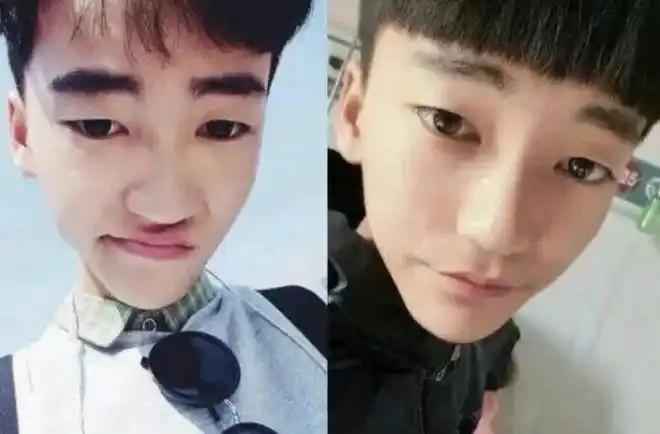 李由承认变性成功自曝术后痛了2个月声称以后还会要小孩