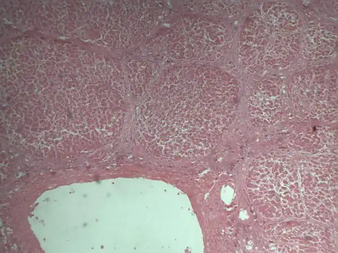 【整理】对于一些基本病理切片的总结