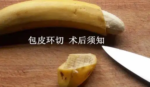 包皮环切术 术后须知_包皮环切术_包皮环切术护理及注意事项 - 好大夫