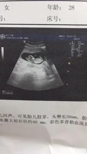 临产前就能知道的测男女方法有哪些"灯火辉煌"-第2张图片-西安论坛