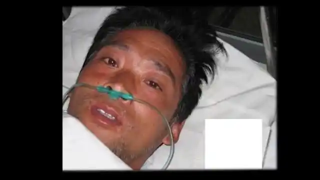 1999年,35岁的日本工人大内久,处理核废料时遭核辐