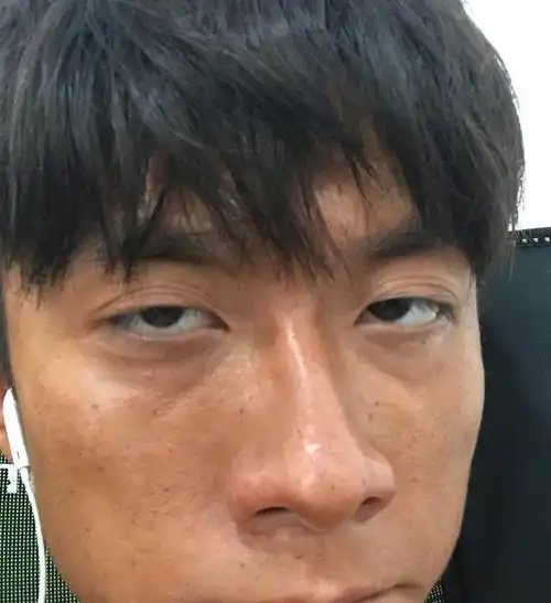 张一山自黑晒丑照撞脸猴子网友注意点形象