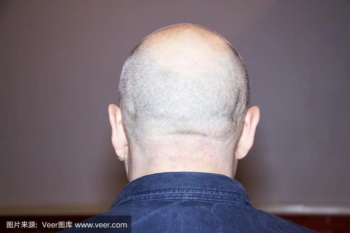 光头男人的背影