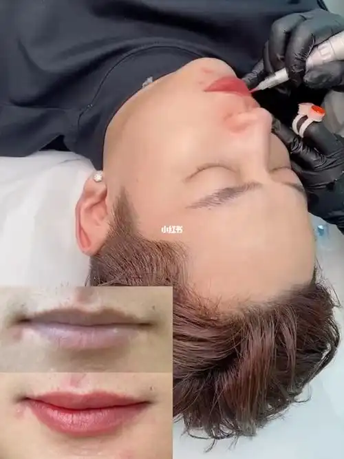 精致男孩有气色男士改乌唇暗唇即刻效果哦