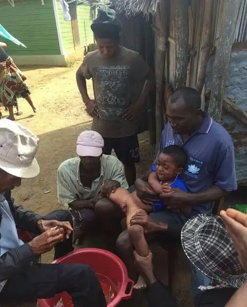 非洲部落孩子割礼不打麻药还载歌载舞