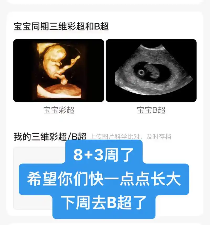 8周 3天,继续孕反高峰期(坚持抗过去)8周 3 孕反依然丝 - 抖音