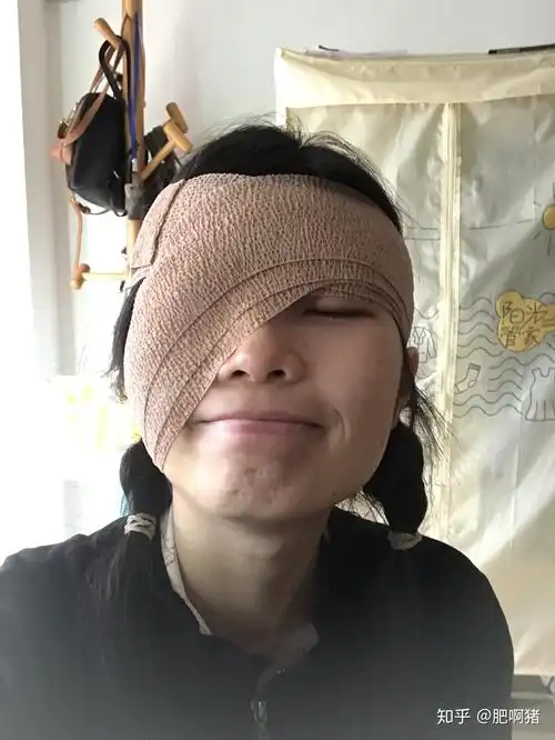 换了绷带和药,其实就是检查眼睛,滴药膏,再绑绷带