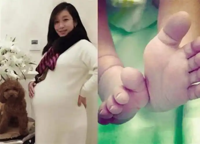 秦海璐37岁生 "巨婴症"儿子,躲过了大龄产子,却没躲过遗传