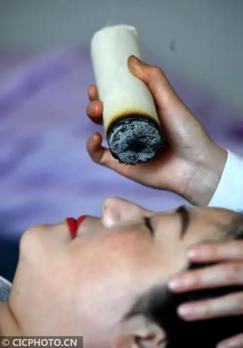 80后牛静的艾灸情结