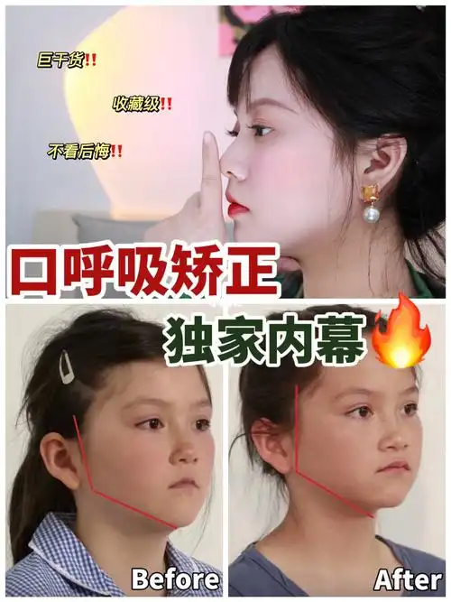 硬核凸嘴干货60毫不费力003min搞定口呼吸