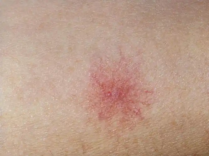 38岁男子不碰烟酒,却因肝癌离世!医生怒斥:妻子是罪魁祸首