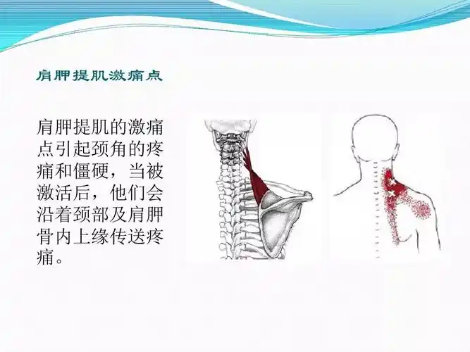 肩背肌筋膜炎的诊断及手法治疗概况