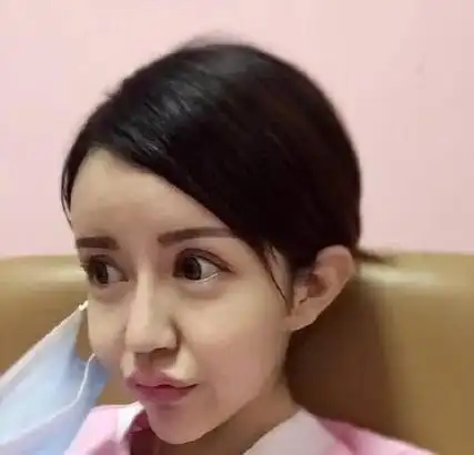 网红脸女孩娜娜,曾3年内整容60余次,把自己整成了"芭比娃娃"_娱乐资讯