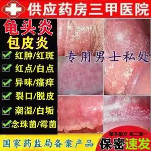 0048人付款天猫龟头炎红点白垢男性异味包皮垢阴茎瘙痒阴囊霉菌珍珠