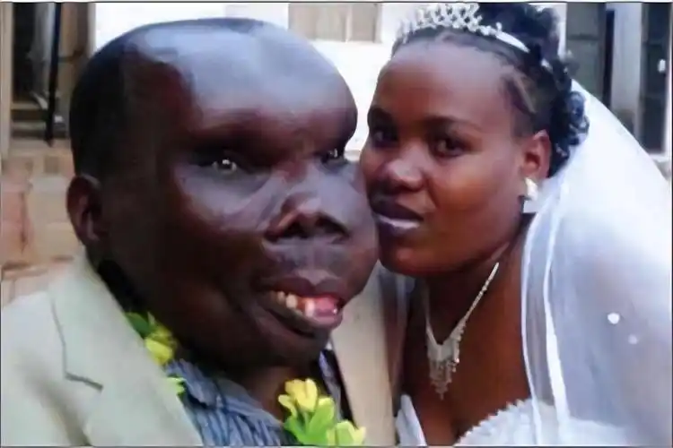 世界上最丑的人世界上最丑的男人