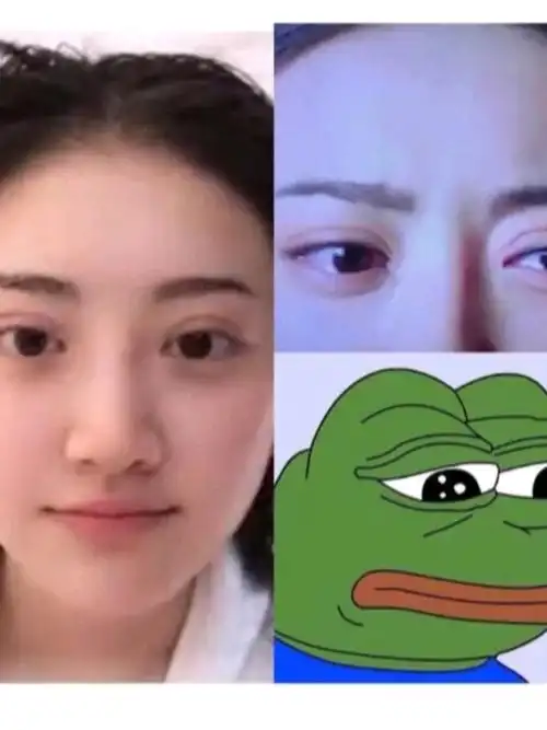 景甜刚出道的时候还是窄窄的小双眼皮,眼尾上挑,看起_圈子-新氧美容