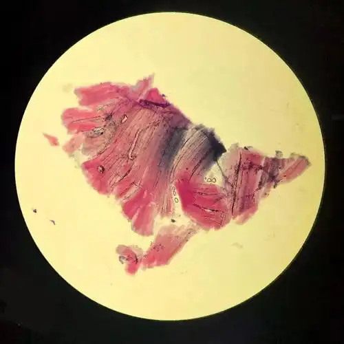脑洞| 镜下宇宙——医学生的微观花园_切片