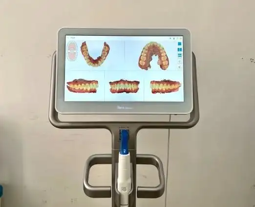 itero口内扫描仪哈尔滨市第二医院口腔科全体医护人员将竭诚为您提供