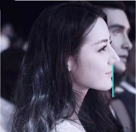 自测自己是不是嘴凸?如何改善?