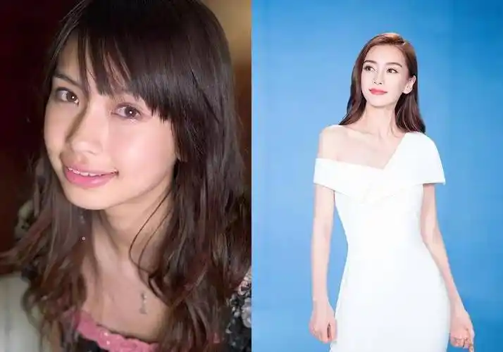 明星们整容前后_明星整容前后对比_整容明星对比照