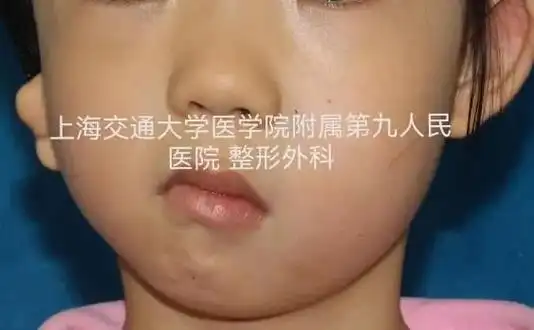 有医说医半面短小也是病既能治也能治好