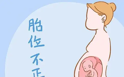 宝宝_胎儿_胎位