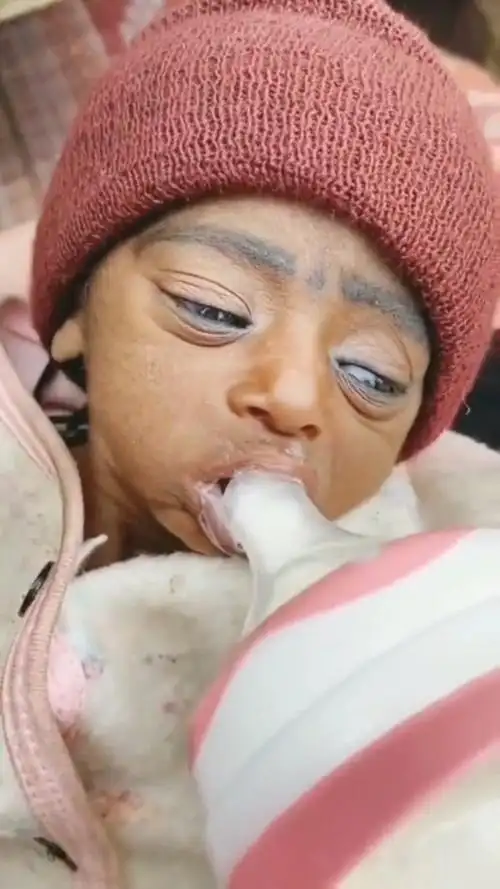 刚出生的婴儿,看这个皮肤,生下来就能领养老金了!