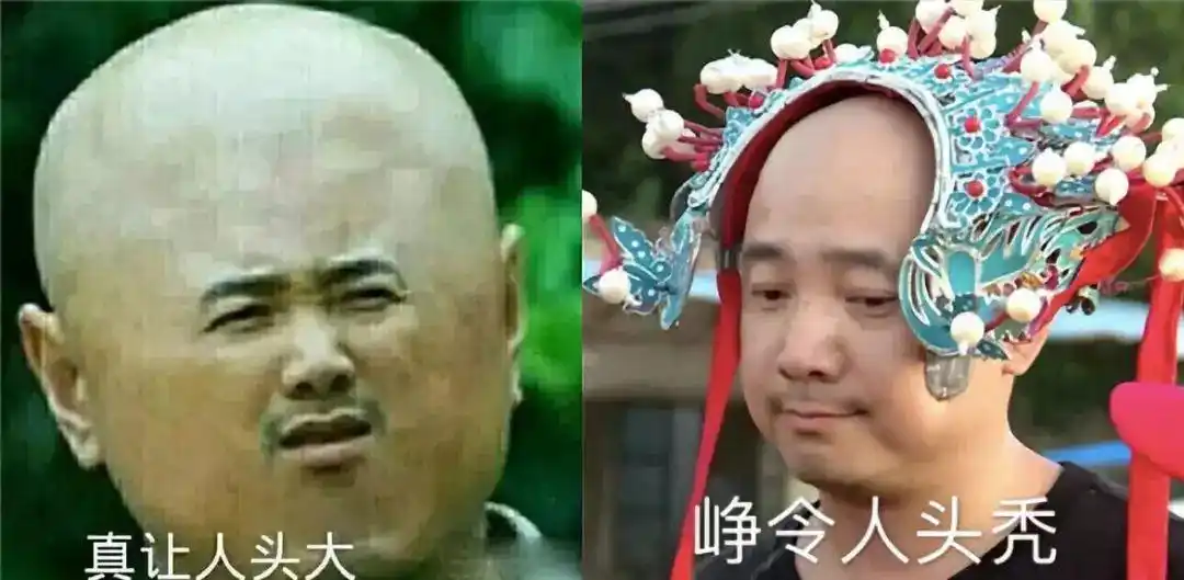 徐峥自曝:20岁就秃顶,疯狂擦生姜不管用,却被群嘲,让人心疼!