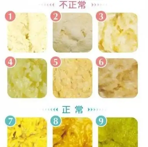 那么,吃母乳婴儿正常大便是什么颜色的,与吃奶粉和添加辅食宝宝所拉的