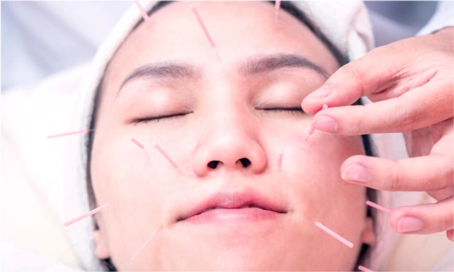 得了面瘫我们应该怎么治疗,嘴歪眼斜好难受