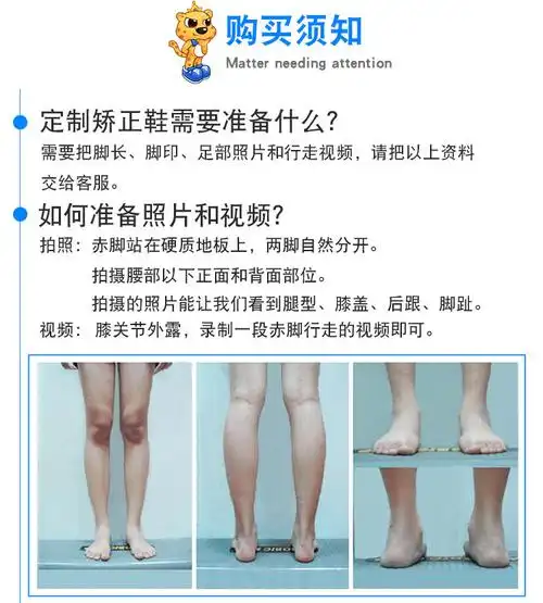 太子豹儿童内八字矫正凉鞋温和反楦足外翻内翻x型o型腿托马斯垫脚