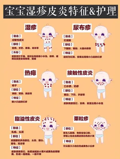 宝宝湿疹热疹痱子如何分辨71新生儿如何护理71