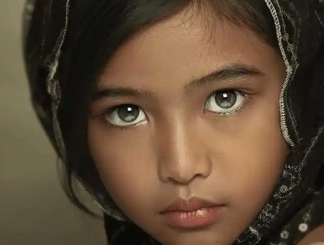 一个普通的小女孩因为一双眼睛全世界都认识了她