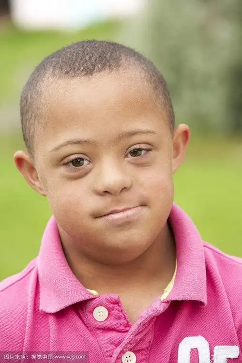 其它 唐氏筛查 写美篇方法 抽取血清,检测母体胎儿蛋白等 参考值及