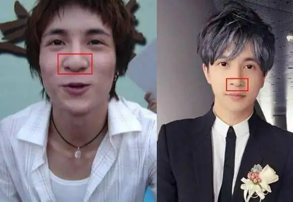 看了薛之谦整容前的旧照李雨桐果然对他是真爱