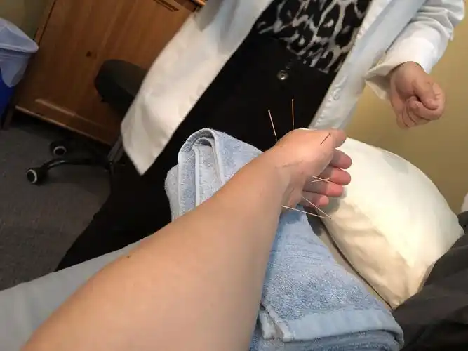 先生在温哥华扎针灸