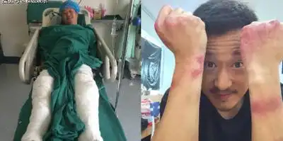 吴京晒图入院,疑似膝盖受伤,做一名合格武打巨星不容易_画面_电影界