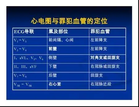 心电图个导联是否代表心脏的具体部位?