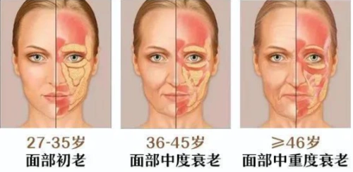 面部衰老也是分层次的面部衰老是由内而外的,即使人类隔绝空气,拒绝